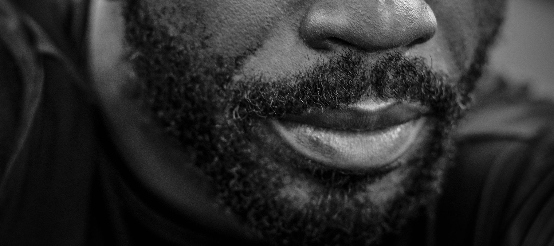 Greffe de barbe - Maison de la greffe capillaire - Paris Trocadéro